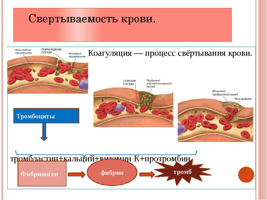 Образование тромба схема егэ